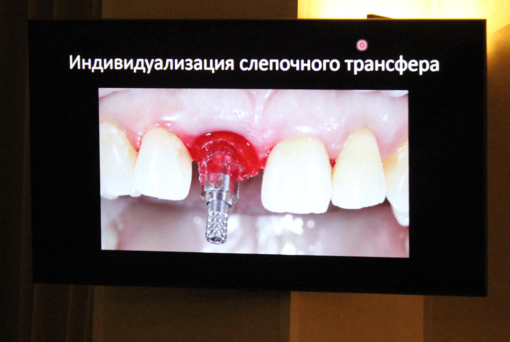 Фотоотчёт с курса Курс для студентов и ординаторов: «Протезирование с опорой на имплантаты. От планирования к реализации». Фото № 3